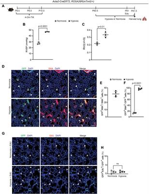 Dedifferentiated early postnatal lung myofibroblasts redifferentiate in adult disease